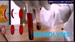 What is hemolysis  what are the causes of hemolysis Hemolysis experiment in vitro [upl. by Emmi]