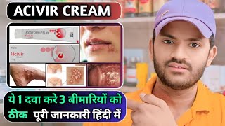 Acivir cream uses dose benefits and Side effects full review in hindihow to use acivir cream [upl. by Jelena]