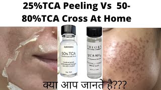 25TCA peeling Vs 80 TCA Cross At Home अपने स्कार्स को पहचाने फिर चुने TCA cross and TCA peel [upl. by Anat700]