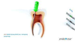 Endostar E3 Big Apical Rotary System  Krok po kroku systemem rotacyjnym [upl. by Aitnahc720]