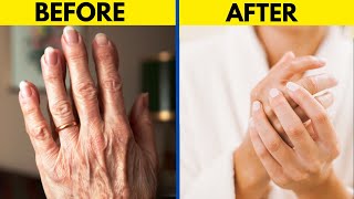 The Ultimate Hand Transformation  Best Remedy for Dryness and Wrinkles [upl. by Suilenroc]