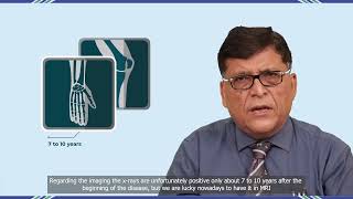 Dr Abhrajit Ray  Diagnosis of Ankylosing spondylitis [upl. by Maziar166]