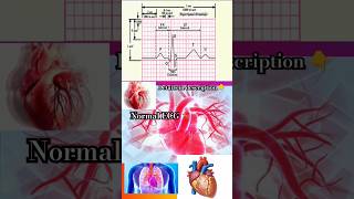 normal🫀ecg🫀heart🫀p QRS t Wave🫀heartattack🫀heart disease🫀viralshorts🫀yt shortsmbbsdoctor [upl. by Gerg]