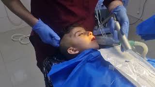 Pediatric Anesthesia in 6years old induction intubation anesthesia [upl. by Eluj]