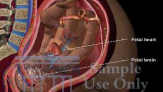 Umbilical Cord Compression  Maternal Fetal Circulation Medical 3D Animation [upl. by Coucher849]