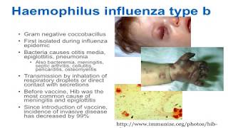 Poliomyelitis  Symptoms and Prevention [upl. by Bluhm365]