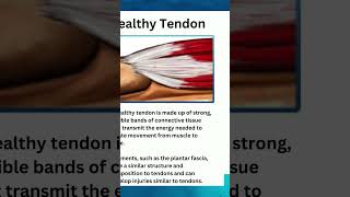 Most tendon injuries fall into two categories Tendinitis and tendinosis [upl. by Ttimme]