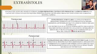 FISIOLOGÍA ARRITMIAS CARDIACAS y SU INTERPRETACIÓN ELECTROCARDIOGRÁFICA [upl. by Sadiras85]