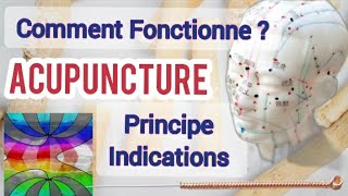 Acupuncture Comment Fonctionne Énergie QI les points Méridiens Techniques principe indications [upl. by Yerdua447]