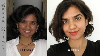 How did I cure cystic acne and rosacea [upl. by Nhor]