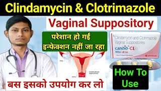 clindamycin and clotrimazole vaginal suppositories  candid cl kaise use kiya jata hai [upl. by Hebert232]